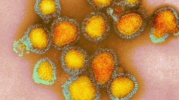 Pernambuco já registra mais de cinco mil casos da gripe H3N2