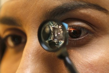 Especialista destaca medidas para prevenir problemas oftalmológicos no verão 