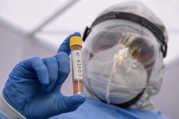 Governo do Estado investiga circulação de variantes do coronavírus no Agreste