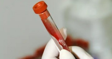 Fábrica em Pernambuco vai abastecer SUS com remédio para hemofilia