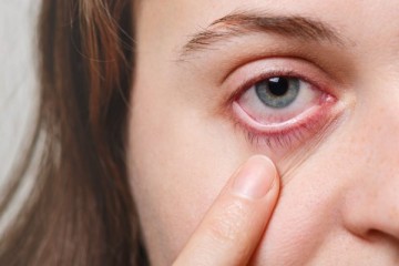 Coronavírus pode ser contraído pelos olhos