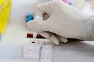 Casos de hepatite a diminuem em Pernambuco 