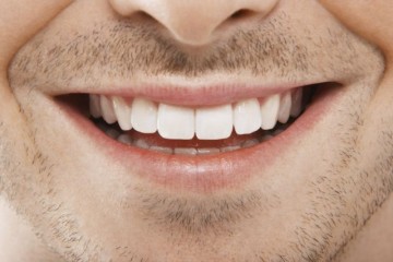 Implante dentário é o procedimento mais adequado para a ausência dos dentes