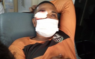 PM que atingiu olho de homem com bala de borracha em protesto no Recife é afastado 
