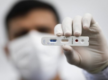 Pernambucanos com sintomas gripais poderão fazer testes da Covid-19