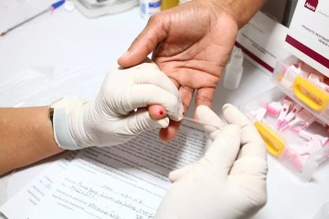 Pernambuco registra primeiro caso de hepatite misteriosa em criança em Toritama. No Brasil, já são 16 registros