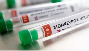 Surubim tem caso confirmado da varíola dos macacos, afirma SES-PE