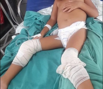 Duas crianças e uma idosa são atingidas por balas perdidas na Zona Oeste do Recife