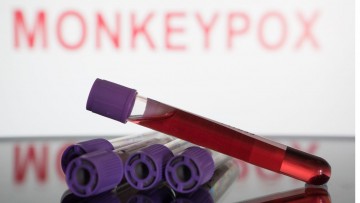 Monkeypox: Pernambuco tem 15 casos confirmados; outras 132 notificações seguem em investigação