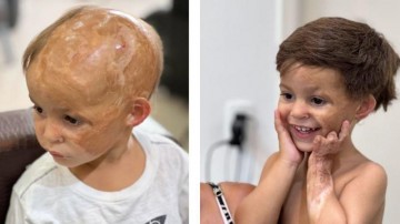 Sertão: confira a reação emocionante de menino ao ver com cabelo pela primeira vez