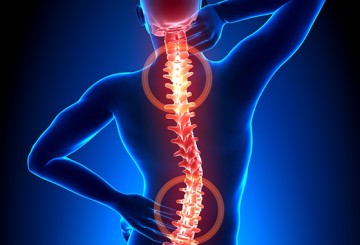 Saiba como evitar fraturas da coluna vertebral