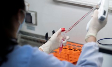 Capes lança programa de pesquisa de combate à epidemias