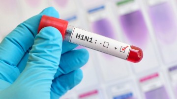 Casos de H1N1 crescem entre adultos; diagnósticos de covid-19 caem