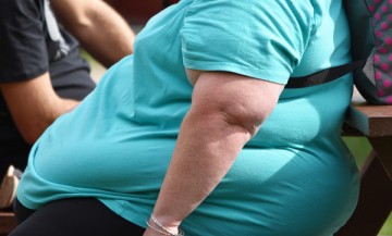 Nutricionista esclarece sobre obesidade mórbida e cuidados que devem ser tomados