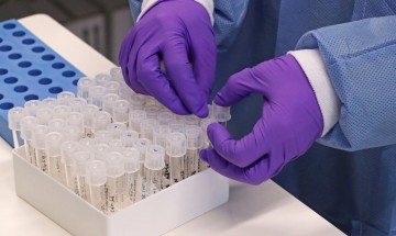 PL estabelece locais aptos a realizar exames do novo coronavírus