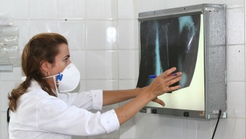 Governo cria comitê para reduzir casos de tuberculose até 2030 (07)