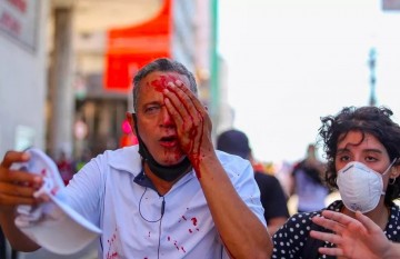 PMs são indiciados por omissão de socorro e lesão corporal em caso de homem atingido no olho por bala de borracha durante protesto pacífico contra o presidente Jair Bolsonaro