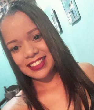 Quadro clinico da jovem Mayara Estefanny Araújo atingida por liquido corrosivo é apresentado 