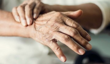 Aproximadamente 1% da população mundial com idade superior a 65 anos tem a doença de Parkinson