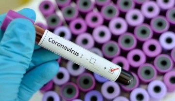 Pernambuco confirma 154 novos casos do coronavírus 