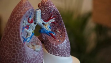 Agosto Branco chama atenção para o câncer de pulmão