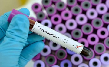 Secretaria de Saúde encaminha aos municípios informações sobre coronavírus