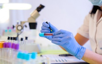 PE amplia número de exames para diagnóstico do novo coronavírus