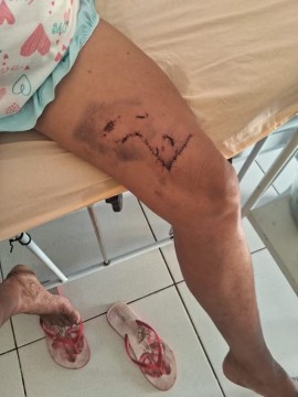 Mulher é atacada por onça-parda no Sertão de Pernambuco