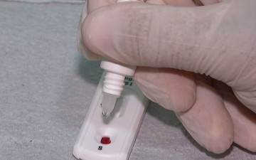 Ministério da Saúde recomenda testes rápidos para diagnóstico de dengue 