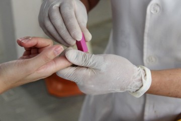 Número de casos diagnosticados de HIV cresceu 657% nos últimos 10 anos