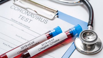 Brasil registra 1.532 mortes por coronavírus