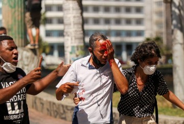 Dois homens atingidos pela PM durante protesto no Recife, perdem parte da visão