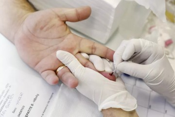 Secretaria de Saúde de Pernambuco confirma terceiro caso de Hepatite Aguda