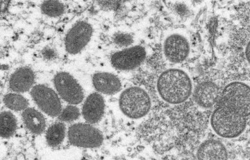 Sobe de 47 para 96 número de casos suspeitos de varíola dos macacos em Pernambuco