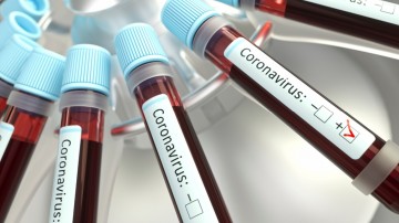 Prefeitura de Caruaru adota novas medidas para conter o coronavírus