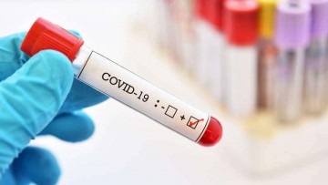 Aumento de casos da Covid-19 no Estado não significa uma segunda onda da doença, afirma SES-PE