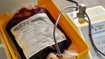 Hemope tem 40% de Redução no Estoque e pede doações de sangue à população