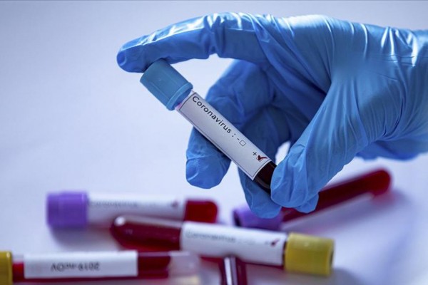 Testes identificam se a pessoa desenvolveu anticorpos