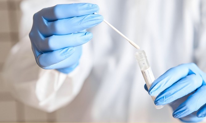 Atualmente, a Secretaria de Saúde do Recife tem capacidade para realizar 11.700 testes rápidos de antígeno por dia
