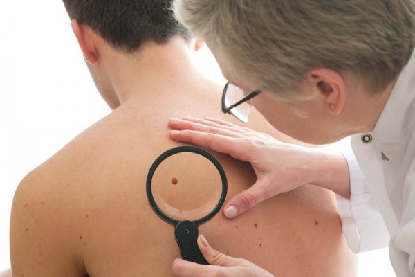 Atenção, 180 mil novos casos por ano são diagnosticados como câncer de pele. 