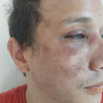 Vítima estava andando em Abreu e Lima, no Grande Recife, quando foi atacado