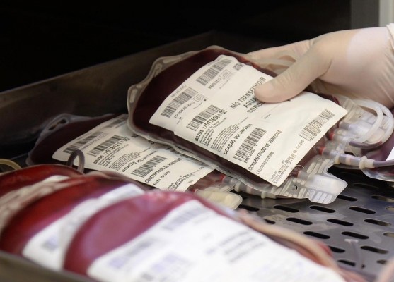 Desde o início do mês de abril, o Banco de Sangue do Hemato está com estoques em estado crítico com um déficit de 40%
