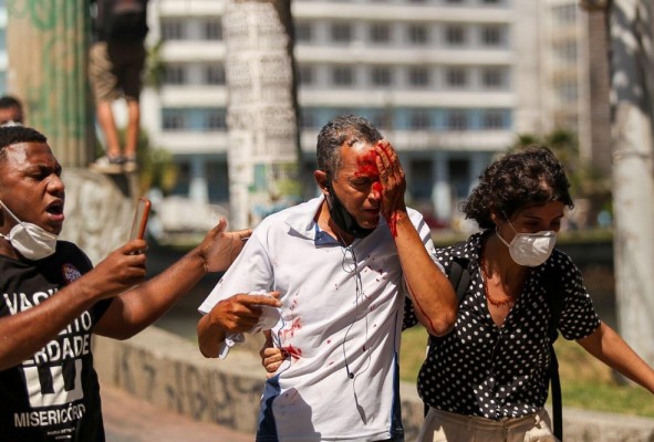 Estado diz que vai indenizar vítimas da ação truculenta da polícia durante ato pacífico contra presidente Bolsonaro