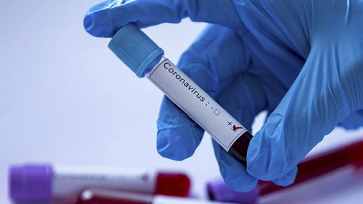 Número de testes com resultado positivo para o novo coronavírus caiu, de quinta para sexta-feira, 16%
