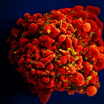 Pandemia de HIV/Aids pode acabar até 2030, diz Unaids