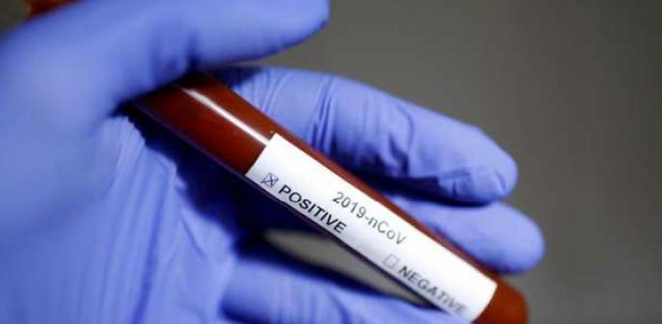 Ministério da Saúde atualiza números de infectados e mortos por coronavírus 