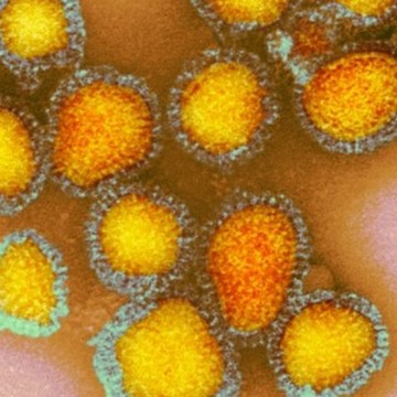 Pernambuco já registra mais de cinco mil casos da gripe H3N2
