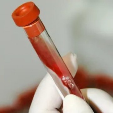 Fábrica em Pernambuco vai abastecer SUS com remédio para hemofilia