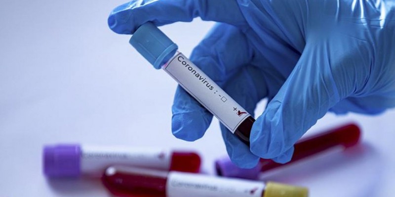 Testes identificam se a pessoa desenvolveu anticorpos