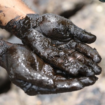 Mais de 80 pessoas são atendidas por contato com o óleo nas praias